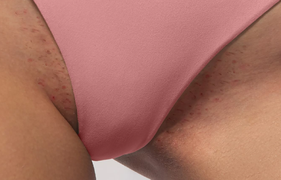 Describes the appearance of the image